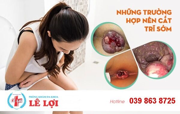 Chi phí cắt trĩ tại VInh Nghệ An
