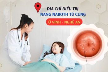 Địa chỉ chữa nang naboth cổ tử cung ở Vinh Nghệ An