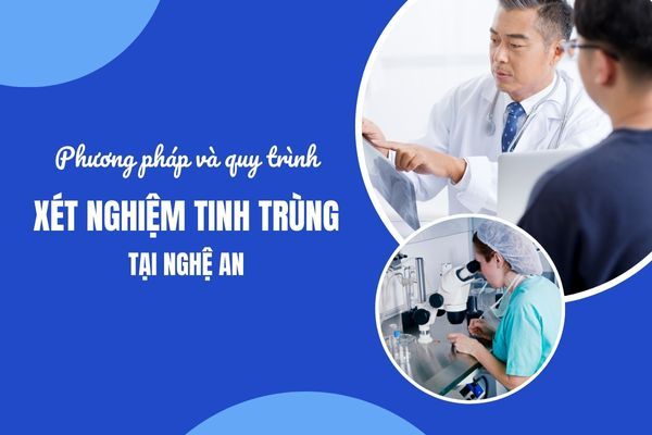 Phương pháp và quy trình xét nghiệm tinh trùng tại Nghệ An