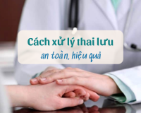 Cách xử lý thai lưu an toàn, hiệu quả