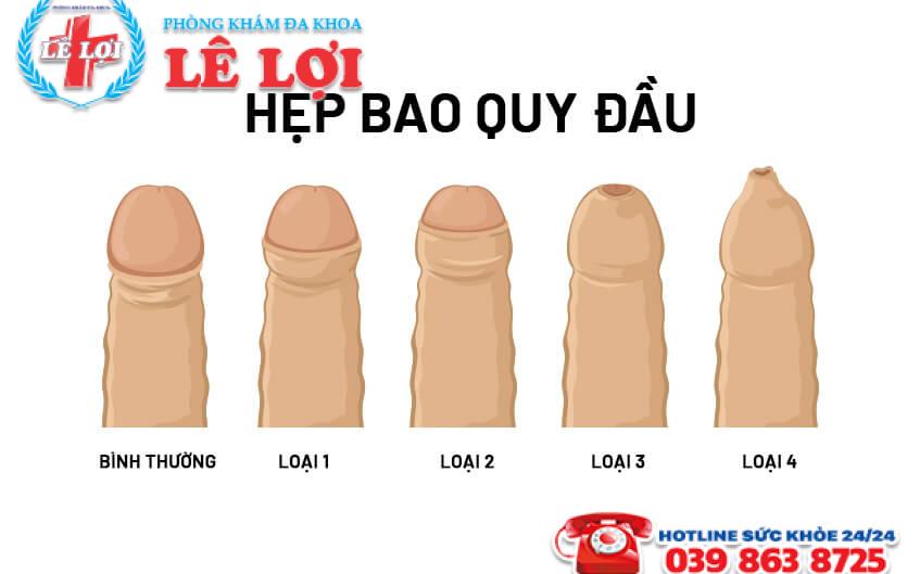 Những cách chăm sóc bao quy đầu sau tiểu phẩu cắt bao quy đầu